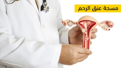 مسحة عنق الرحم