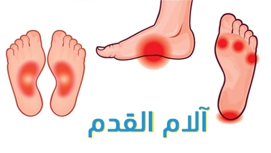آلام القدم 