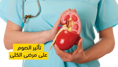 تأثير الصوم على مرضى الكلى