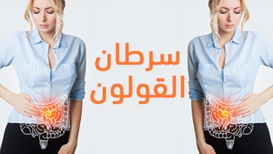 سرطان القولون