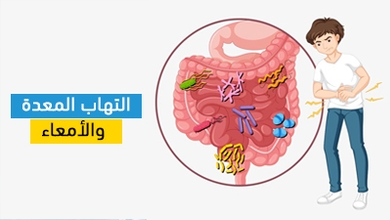 التهاب المعدة والأمعاء