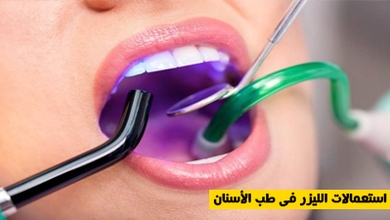 استعمالات الليزر في طب الأسنان