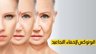 البوتوكس لإخفاء التجاعيد