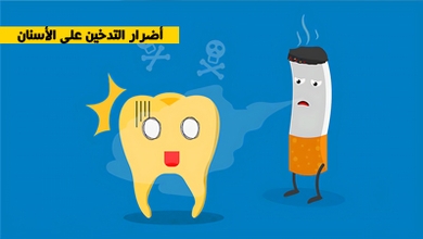 أضرار التدخين على الأسنان