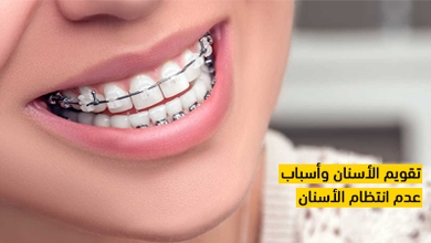 تقويم الأسنان وأسباب عدم انتظام الأسنان