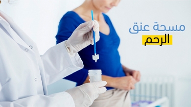 مسحة عنق الرحم