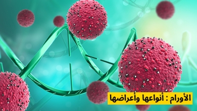 الأورام : أنواعها وأعراضها