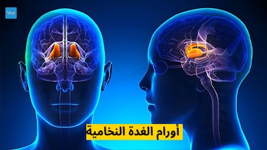 أورام الغدة النخامية