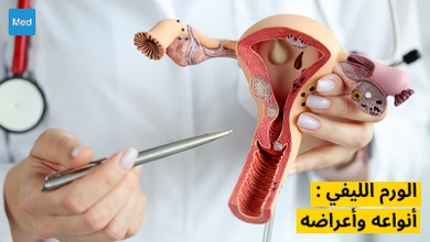 الورم الليفي : أنواعه وأعراضه