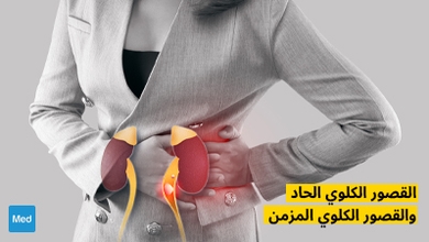 القصور الكلوي الحاد والقصور الكلوي المزمن