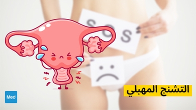 التشنج المهبلي