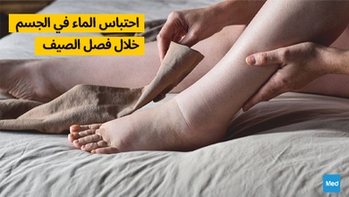 احتباس الماء في الجسم خلال فصل الصيف