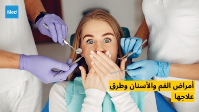 أمراض الفم والأسنان وطرق علاجها