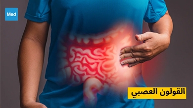 القولون العصبي