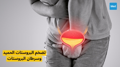 تضخم البروستات الحميد وسرطان البروستات