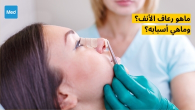 ماهو رعاف الأنف؟ وماهي أسبابه؟