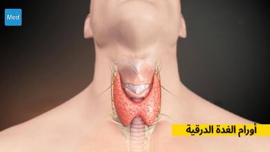 أورام الغدة الدرقية