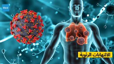 الالتهابات الرئوية