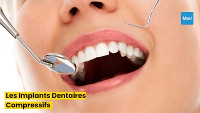 Sourire Confiant : Tout ce que Vous Devez Savoir sur les Implants Dentaires Compressifs