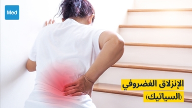 الإنزلاق الغضروفي (السياتيك): الأسباب والأعراض والتشخيص والعلاج