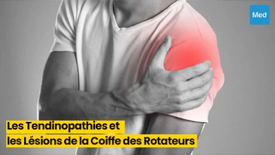 Comprendre et Gérer les Tendinopathies et les Lésions de la Coiffe des Rotateurs