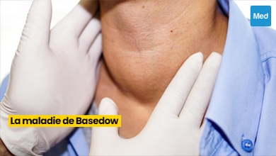 La Maladie de Basedow : Comprendre, Gérer, Vivre