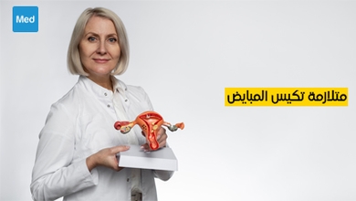 متلازمة تكيس المبايض : الأعراض والأسباب والعلاج