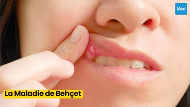 La Maladie de Behçet