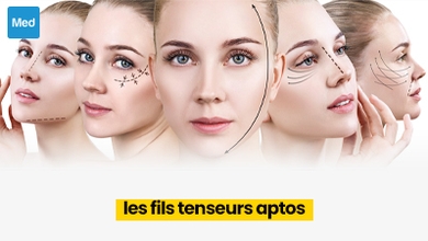 Les fils tenseurs APTOS: un lifting sans chirurgie