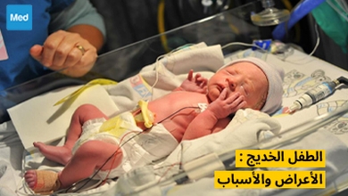 الطفل الخديج: الأعراض والأسباب