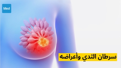 سرطان الثدي وأعراضه