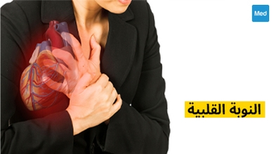 النوبة القلبية 