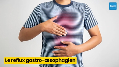 Reflux gastro-œsophagien (RGO) : causes, symptômes et traitement