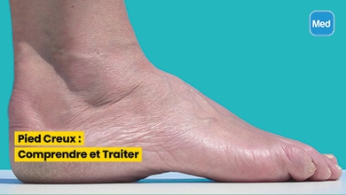 Pied Creux : Comprendre et Traiter