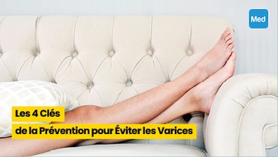 Les 4 Clés de la Prévention pour Éviter les Varices