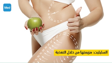 السليليت هزيمتها من خلال التغذية