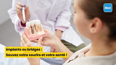  Implants ou bridges : Sauvez votre sourire et votre santé !