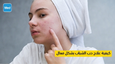كيفية علاج حب الشباب بشكل فعال