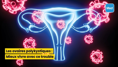 Les ovaires polykystiques : Mieux vivre avec ce trouble