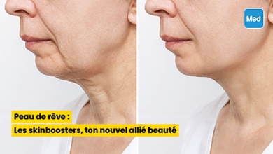 Peau de rêve : Les skinboosters, ton nouvel allié beauté
