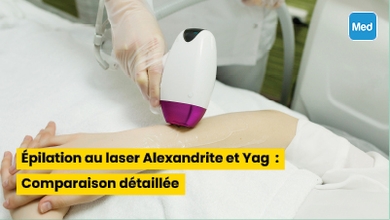 Épilation au laser Alexandrite et Yag : Comparaison détaillée