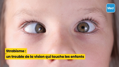 Strabisme : un trouble de la vision qui touche les enfants