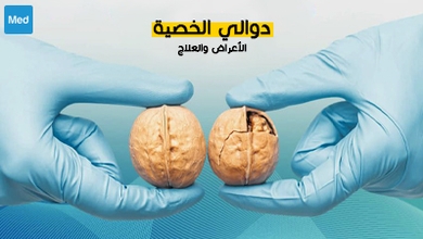 دوالي الخصية : الأعراض والعلاج