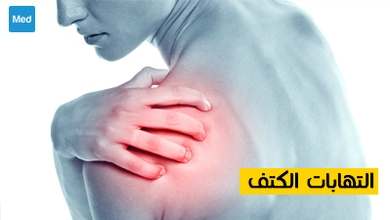 التهابات الكتف 
