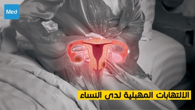 الالتهابات المهبلية لدى النساء