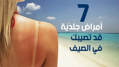 أمراض جلدية قد تصيبك في الصيف 7 