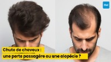 Chute de cheveux : comment distinguer une perte passagère d’une alopécie ?