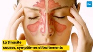 La Sinusite : Comprendre les causes, les symptômes et les traitements modernes