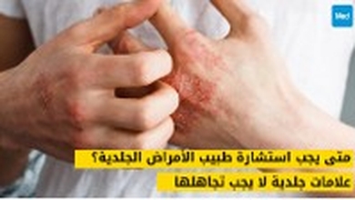 متى يجب استشارة طبيب الأمراض الجلدية؟ علامات جلدية لا يجب تجاهلها