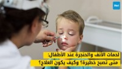 لحمات الأنف والحنجرة عند الأطفال : متى تصبح خطيرة؟ وكيف يكون العلاج؟